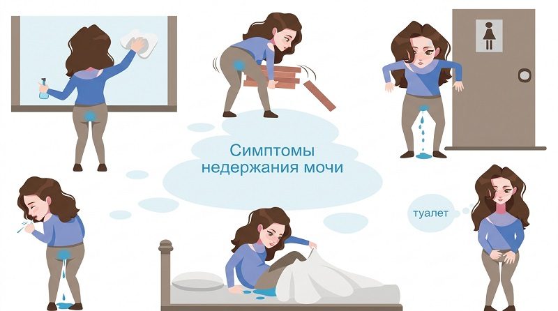Недержание мочи: это не просто «возрастная проблема»